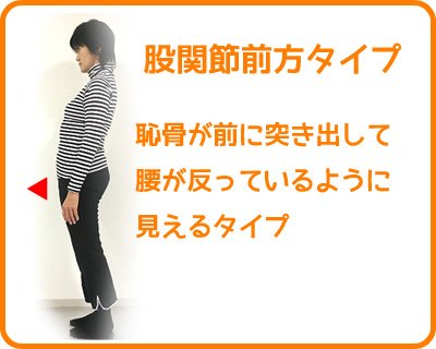 反り腰の原因と姿勢のパターン からだケアルーム クオリア 相模原市南区古淵の整体院