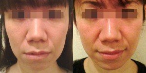 face11