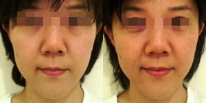 face15